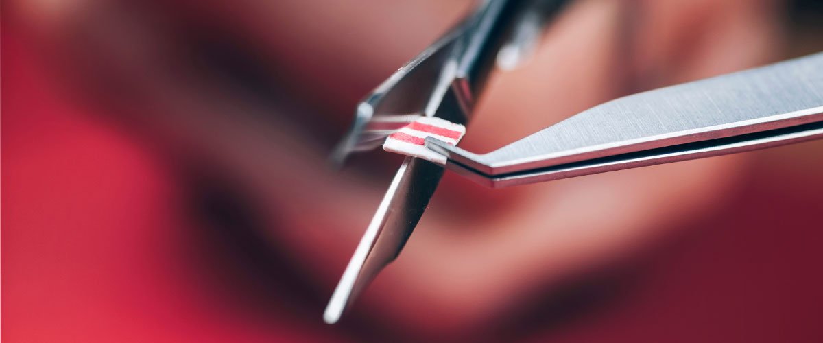 What Is LSD Microdosing