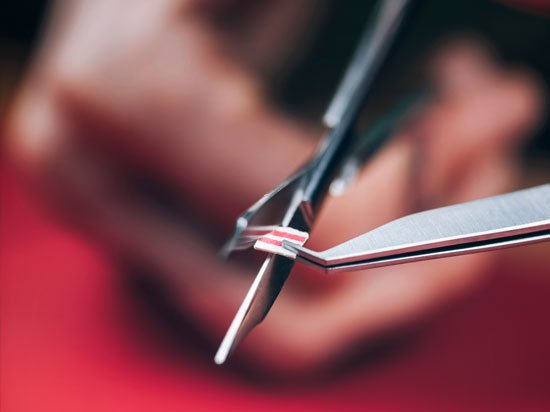 What Is LSD Microdosing